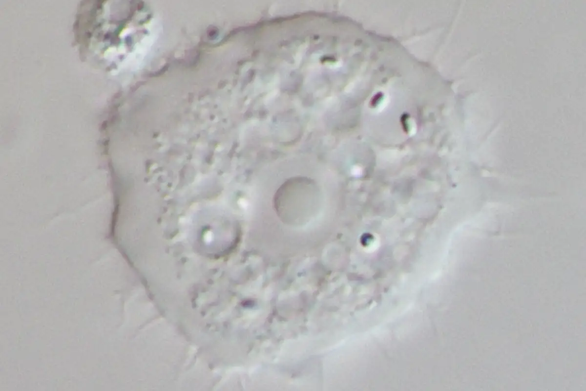 Патогенная акантамеба, вид под световым микроскопом. 